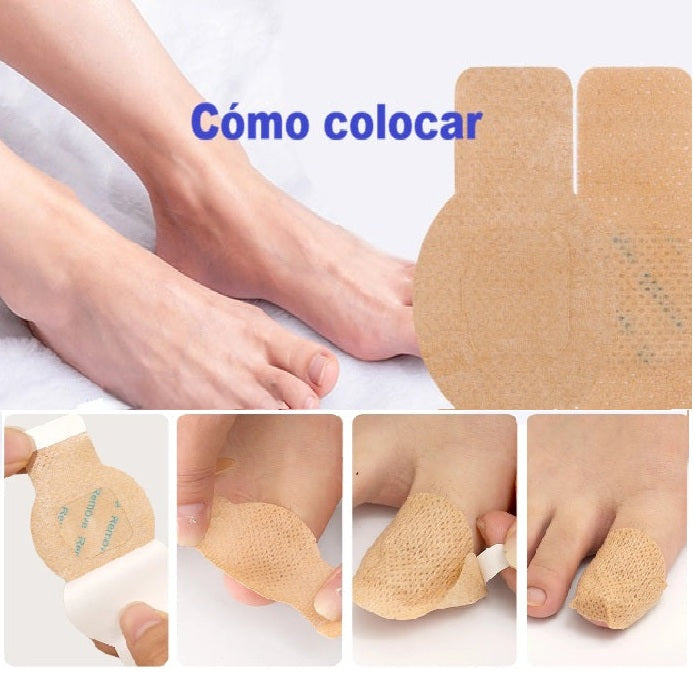Parches impermeables para reparar hongos en las uñas